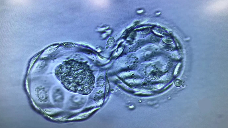 试管婴儿胚胎辅助孵化